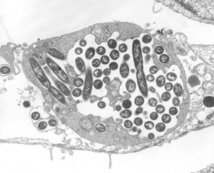 an image of the legionella bacteria embedded in lung tissue as seen through a microscope